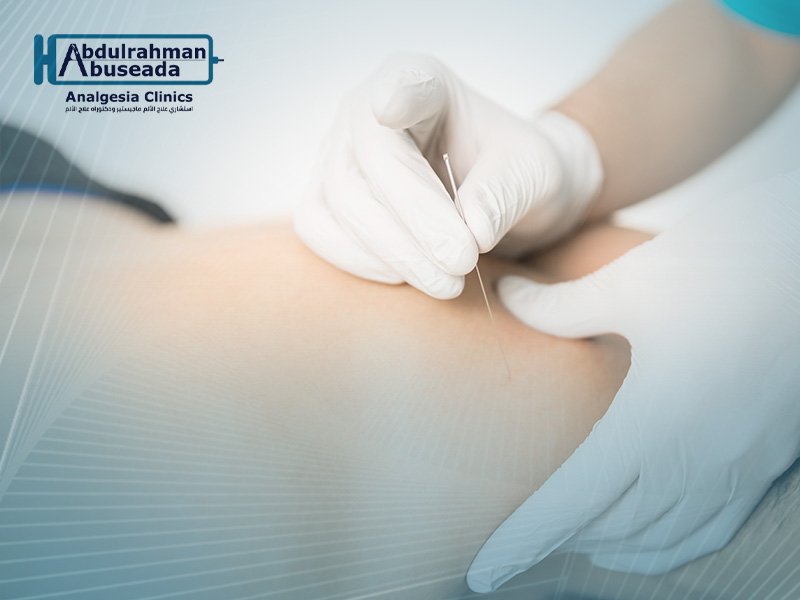 علاج الألم بالتدخل المحدود