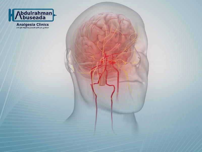 التهاب العصب الثلاثي